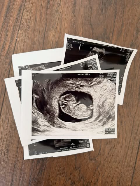 Bergeson family announcement shared by Shane Bergeson